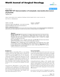 Báo cáo khoa học: "FDG PET-CT demonstration of metastatic neuroendocrine tumor of prostate"