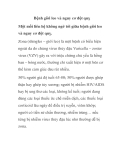 Bệnh giời leo và nguy cơ đột quỵ 