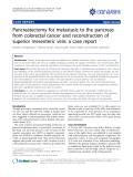 báo cáo khoa học: "Pancreatectomy for metastasis to the pancreas from colorectal cancer and reconstruction of superior mesenteric vein: a case report"