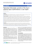 báo cáo khoa học: "Pigmented villonodular synovitis of the hip in systemic lupus erythematosus: a case report"