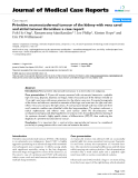 Báo cáo y học: "Primitive neuroectodermal tumour of the kidney with vena caval and atrial tumour thrombus: a case report"