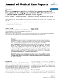 Báo cáo y học: " Fluorodeoxyglucose-positron emission tomography/computed tomography in the staging and evaluation of treatment response in a patient with Castleman's disease: a case report"