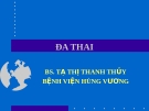 Đa thai