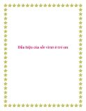 Dấu hiệu của sốt virut ở trẻ em.