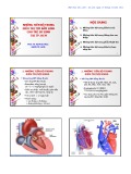 Bài giảng Những tiến bộ trong điều trị tim bẩm sinh cho trẻ sơ sinh tại Tp. HCM - PGS. TS. Vũ Minh Phúc
