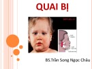 Bài giảng Quai bị - BS.Trần Song Ngọc Châu