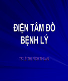 Bài giảng Điện tâm đồ bệnh lý - TS. Lê Thị Bích Thuận