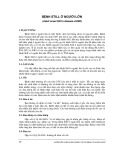 Bệnh Still ở người lớn (Adult onset Still’s disease - AOSD)